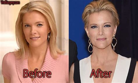 There’s No Arguing About Megyn Kelly’s Bikini。